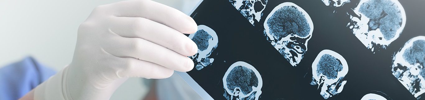 Neurologia