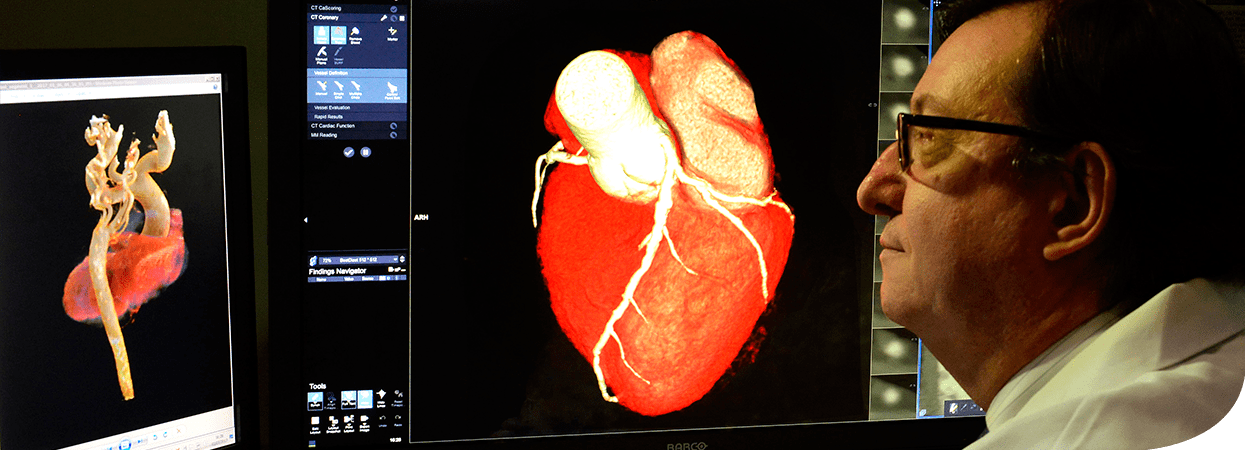 Ressonancia magnética e tomografia cardiovascular