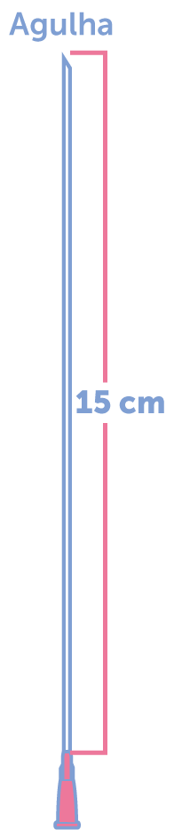 A cirurgia fetal utiliza uma agulha de 15cm Cirurgia fetal no HCor