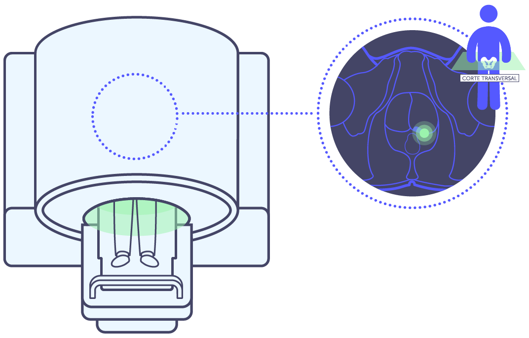 Ressonância magnética multiparamétrica