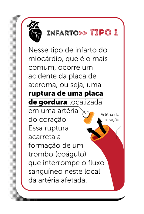 Quais os sintomas do ataque cardíaco ou infarto?