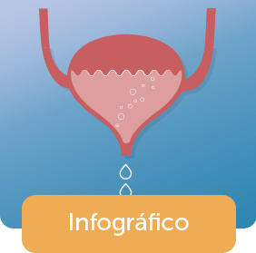 Câncer de bexiga - Infográfico