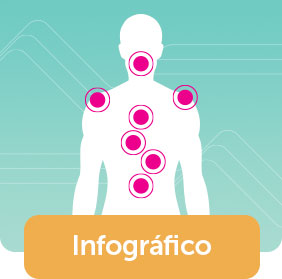 Infográfico doenças cardiovasculares em mulheres