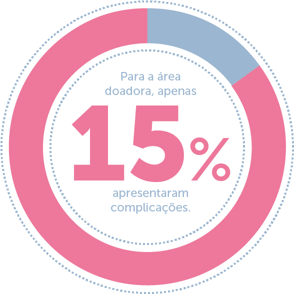 Apenas 15% dos casos de microcirurgia reconstrutiva apresentaram complicações