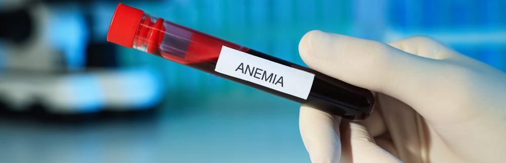 Anemia: saiba mais sobre as causas e sintomas